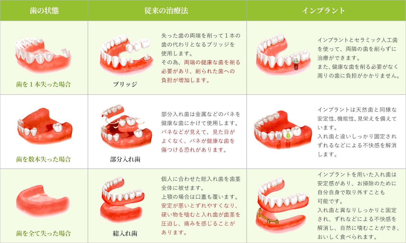 インプラント治療比較