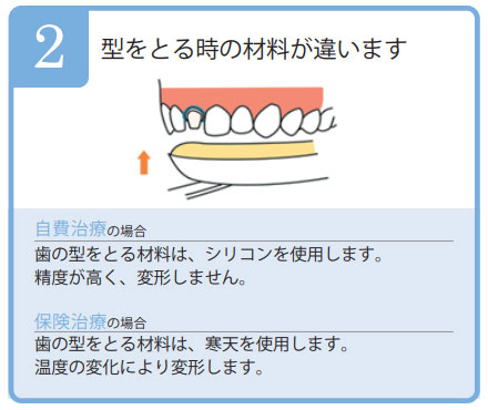 型をとる時の材料