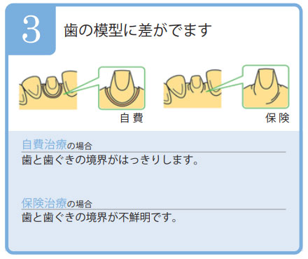 型の模型