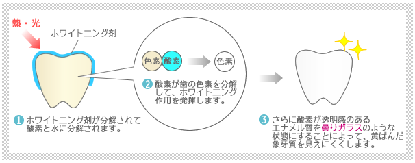 ホワイトニング